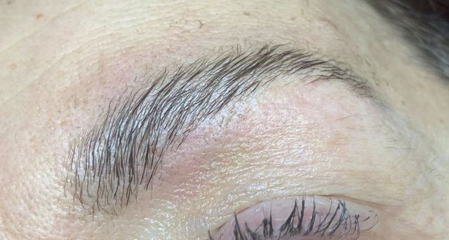 Brow lift voorbeeld 2
